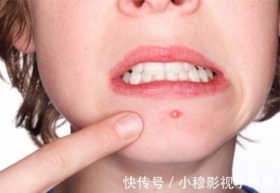 保护肝脏|肝癌不痛不痒发现就是晚期,从这3个地方可以分辨出肝脏的好坏