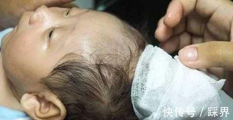 独角兽|奇闻;怀胎十月生下“独角兽”,得知检查结果后奔溃,结局暖心