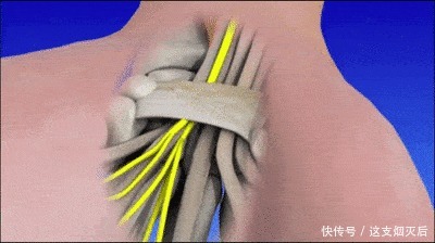  手部麻木的7种常见病因、如何鉴别及治疗