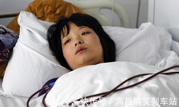 杨桃|尿毒症大多是吃出来的!试着远离三种食物,就能远离尿毒症疾病!