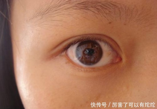 血液|血管“清洁工”被发现,不是木耳,你若爱吃,降血脂,血管干净净