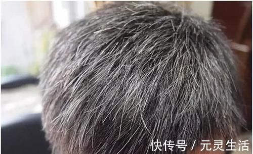 乌黑|少白头越来越多，常吃几种食物，白头发慢慢变乌黑