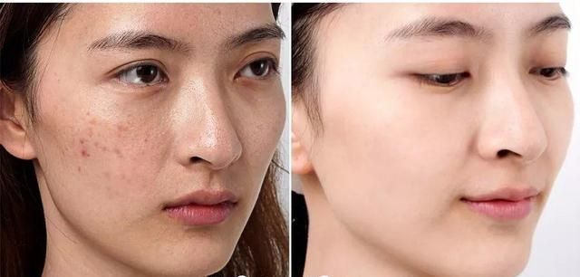 智商税|熬夜就用“熬夜霜”?这种智商税的东西为什么还有人信