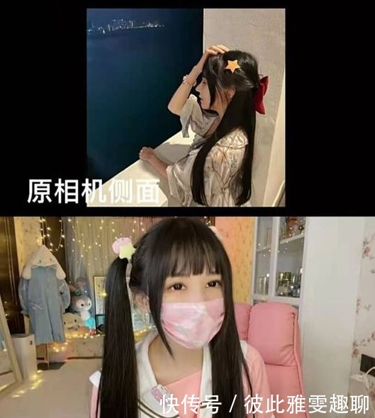 修复|网红蔡萝莉鼻子修复后，大方晒全脸照，五官精致让人心动