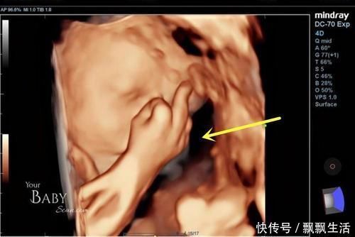 淘气|胎儿性格隔着肚皮能看出来吗？孕期欢脱的胎儿，出生后也多调皮