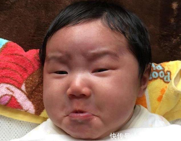 黄疸|从小3个部位越丑的娃,长大颜值越“逆天”,中一条就偷着乐吧