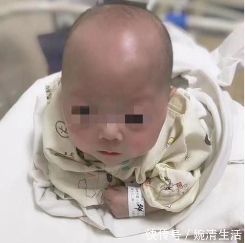 奶粉|那个出生才4百克的“巴掌公主”,半年过去怎样了?生命真是神奇
