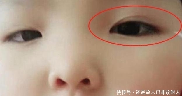 现状|妈妈想让娃变美,亲手为6岁女儿“割双眼皮”,孩子现状让人心疼