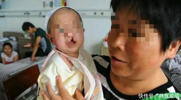 怀孕期间|孕妇生下“兔唇宝宝”,谎称自己孕期吃多了兔肉,被医生无情揭穿
