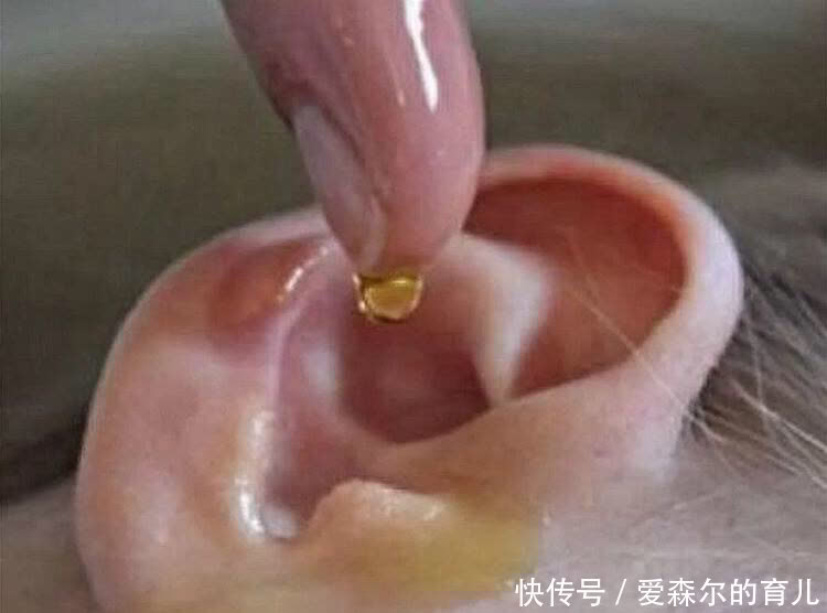孩子|娃耳朵进虫子,妈妈果断地处理方式救了孩子的听力,连医生都夸赞