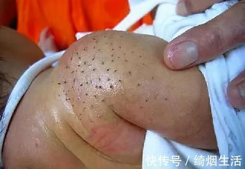 宝妈|宝宝夜里哭闹不止,用梳子刮一刮就好了?别让你的无知“害了”娃