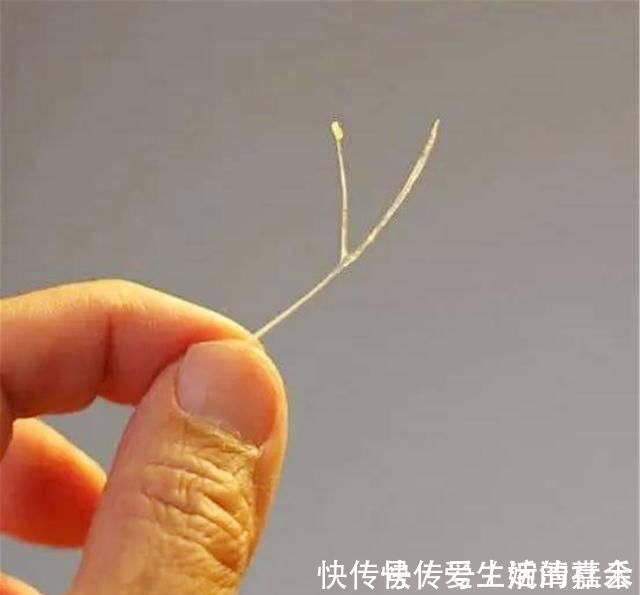 卡住|4岁宝宝鱼刺卡喉,医生称赞:父母的两个果断处理,救了孩子