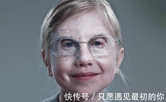 先天性|国外奇葩婴儿“返老还童”,一出生如同80岁老头,父母不惊反喜!