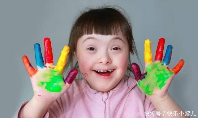 病症|宝妈发视频调侃儿子像“胡巴”,网友看后却急了:快送去医院检查