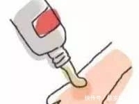 皮肤|在皮肤上用药膏,要轻按不要涂搽