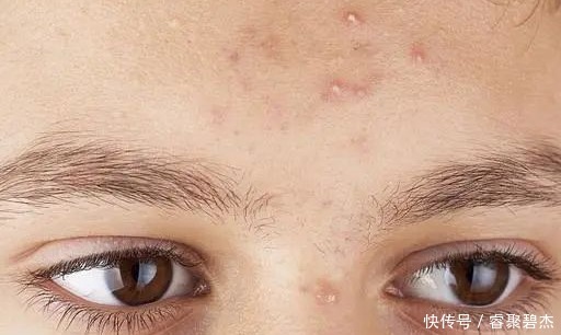 體內濕氣太重?學會這些小技巧,跟體內濕氣說再見