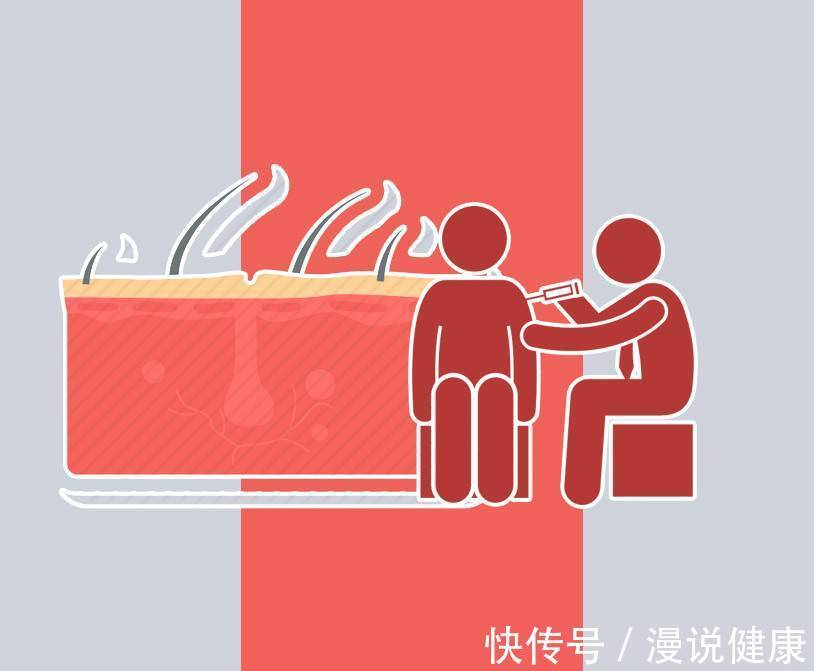 脱发 植发一次最低上万元?90后的朋友们,守住发际线,还得做好2件事