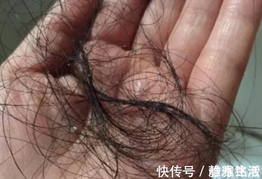 头发|头发多久洗一次最正常?理发师建议:超过这个数,头发会越来越油