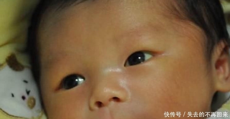 怀孕期间|儿科医生:想要孩子出生没黄疸,孕期得坚持“三不做”,别不信