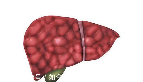 肝部|肝部变硬时,身体会出现4个“异象”,早点发现,肝脏或还有的救