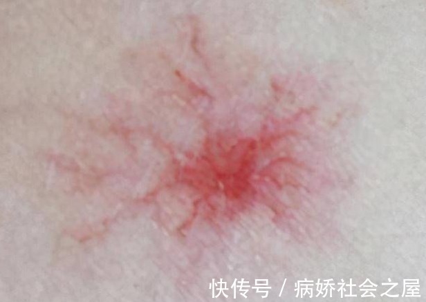 养肝|40岁以后身体有这5个现象,或是肝脏在向你呼救,再不重视就迟了