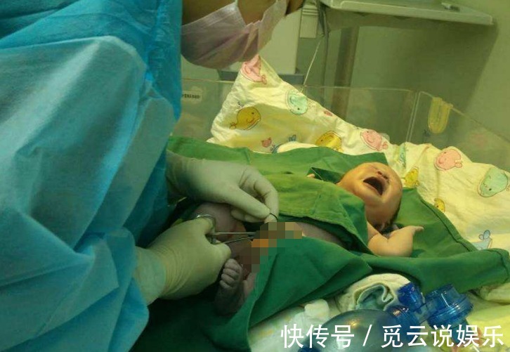 胎儿|怀孕八个月肚子巨大,医院检查一切正常,生产那天丈夫着急了