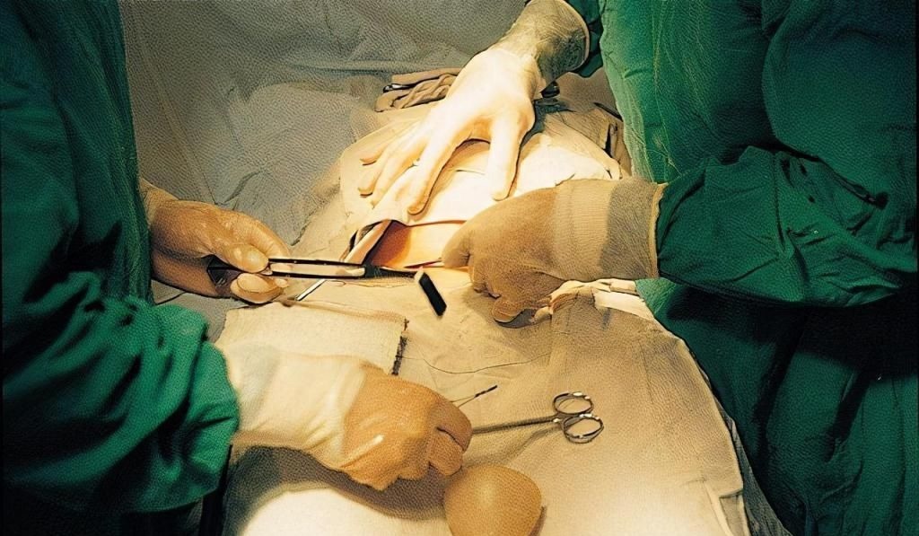 产科医生|剖腹产选择“横切”还是“竖切”?别轻视这一刀,两者效果大不同