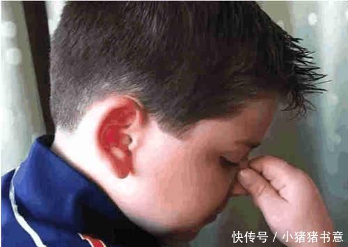 为什么秋冬季孩子总是流鼻血 竟然是这些