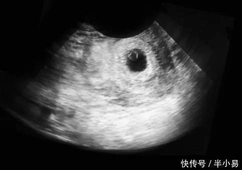 怀孕|揭秘：怀孕22天，准妈妈和胎宝宝的变化