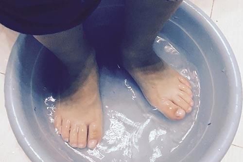 真菌|脚气为何难治愈，一直反复复发？教你治脚气的方法，在家就能做