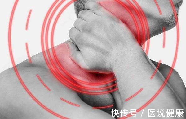 高发人群|这5类人是颈椎病高发人群，若你在其中，需重视起来