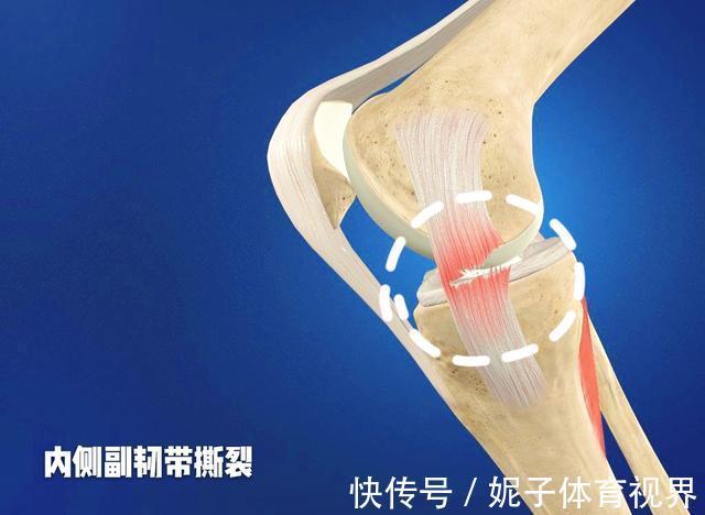 患者|膝盖疼,就是得滑膜炎了?医生辟谣,教您一步步判断自己的病因