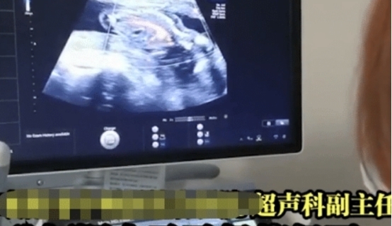 怀孕|40多岁女子肚子胀气去检查，医生：你怀孕了，孩子脚都出来了
