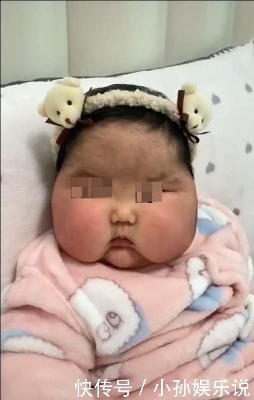 剂量|惊人反转?宝宝被大剂量涂抹面霜?大头娃娃父母被质疑了!