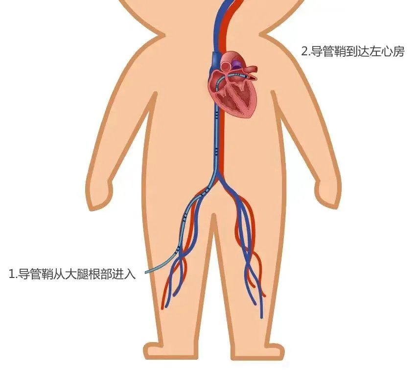 心内科|2021.9.29世界心脏日｜以心相连，共护“心”健康