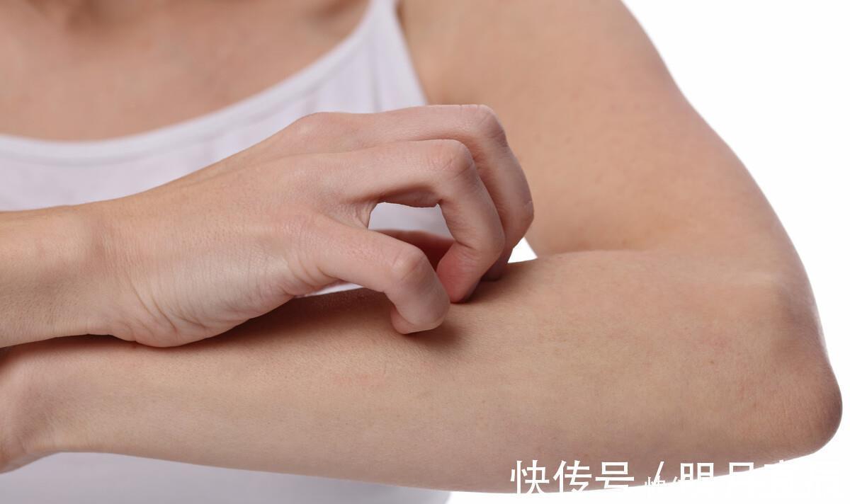 染发|头发染什么颜色,过敏风险最小?做好皮肤测试,才能放心染发