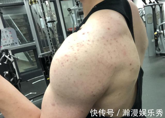 类固醇|肌肉这么发达是不是打了药?通过8点迹象辨别是否使用了类固醇