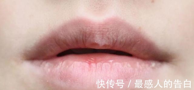 皮肤干燥 唇部护理有多重要没做好涂再贵的口红也是浪费,很多人都忽视了!