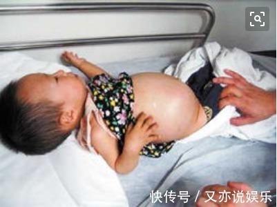 宝宝|1岁宝宝胃被撑破，心脏停跳！检查后医生大怒家长太无知