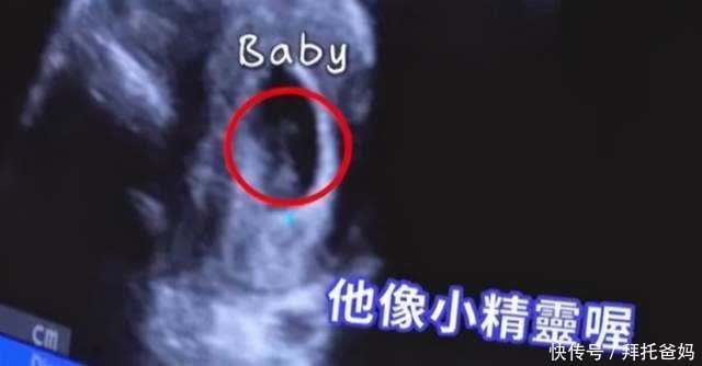 孕妈最怕见红，出血＝流产？出现这些情况…要立即就医