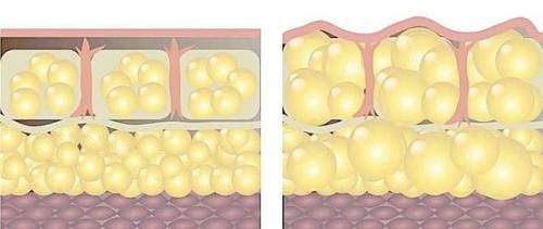来源|搞清楚脂肪的来源以及消耗，帮助我们更好的减肥，治标也治本
