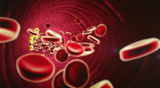 饮食|血脂高了怎么办医生提醒8种方式,10个饮食原则,远离高血脂