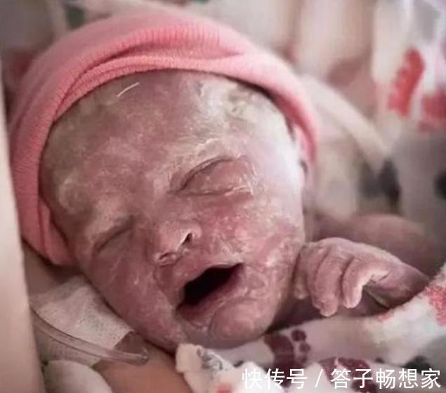 怀胎|怀胎11个月产下“牛奶宝宝”,全家紧张万分,护士恭喜宝妈