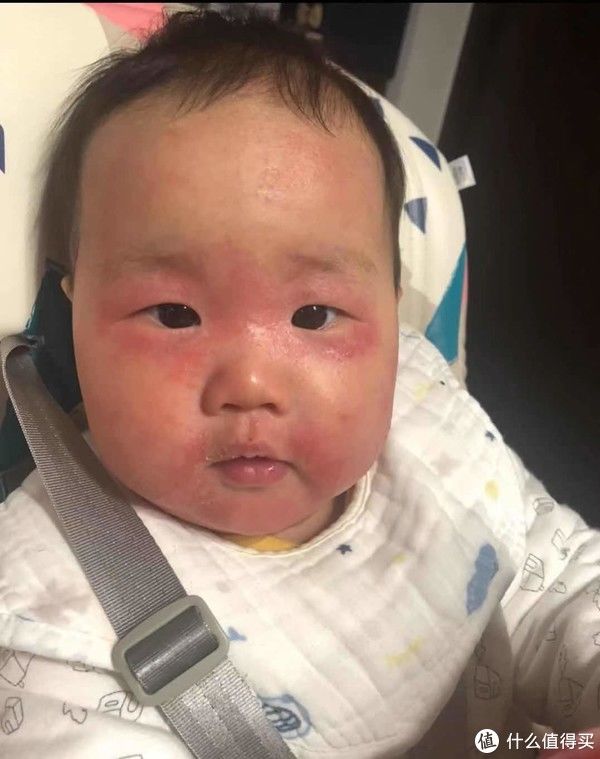 疹子|宝宝湿疹保湿霜哪家强?快来看看,避免入坑
