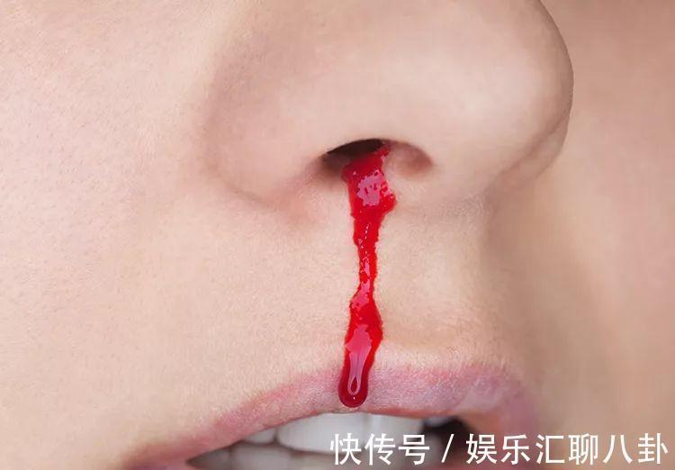 乳酸|早期肝硬化,身体会浮现出“9大症状”,占一半以上,要及时就医