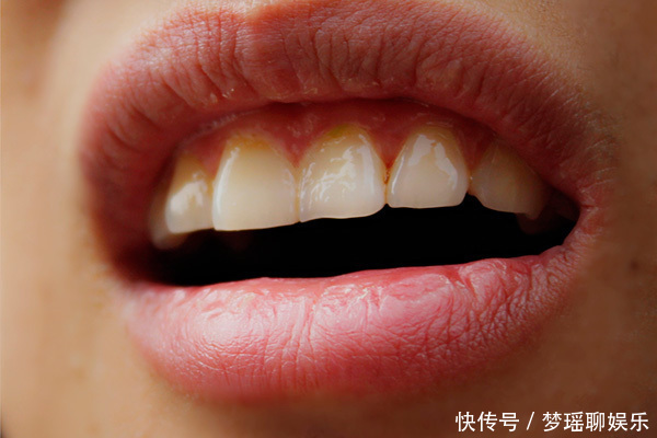 泡水|花椒搭配它,效果或堪比“泻药”,没事喝两口,口臭便秘绕着你走