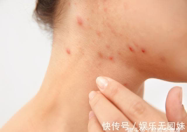 寒毒|寒毒凝于筋,影响到气血运行,3个方法,把身体内的寒毒排出去