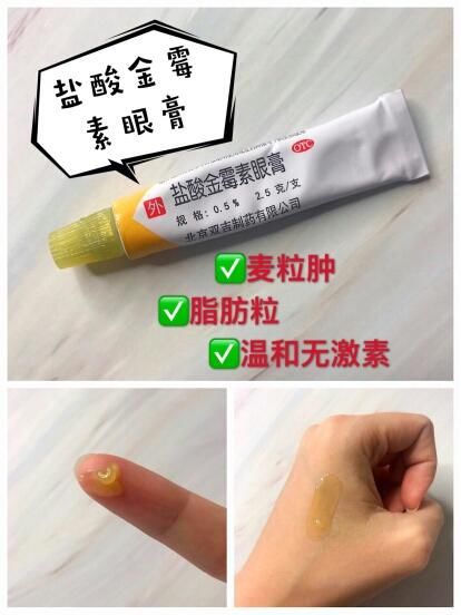 家里必备药膏,小问题再也不用求医了!你买对了吗?