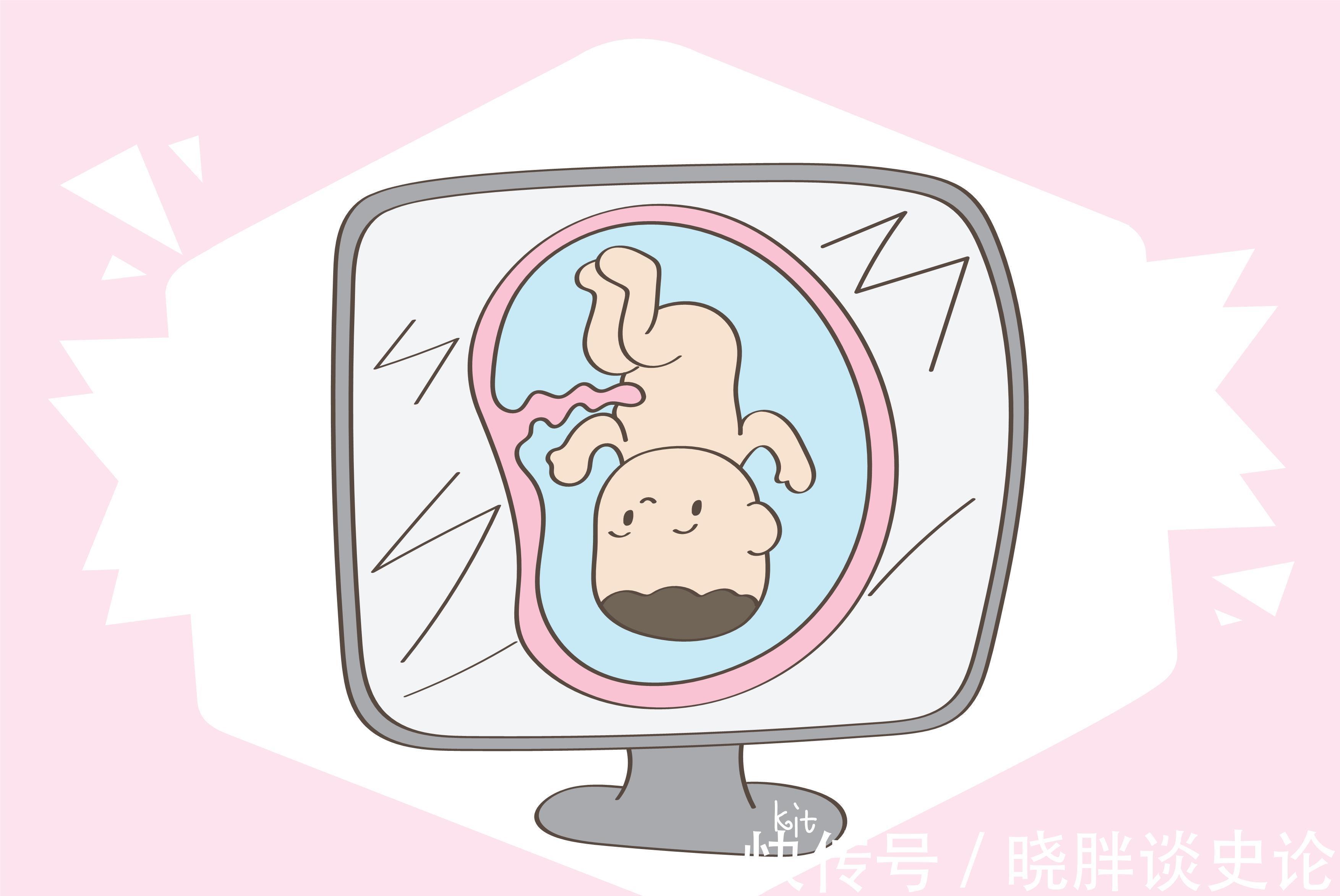 宝宝|胎儿是如何从产道钻出来?其实这是胎儿默默努力的成果!