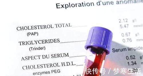 降血脂|高血脂的“天敌”被发现,经常泡水喝,坚持1月,甘油三酯不见了